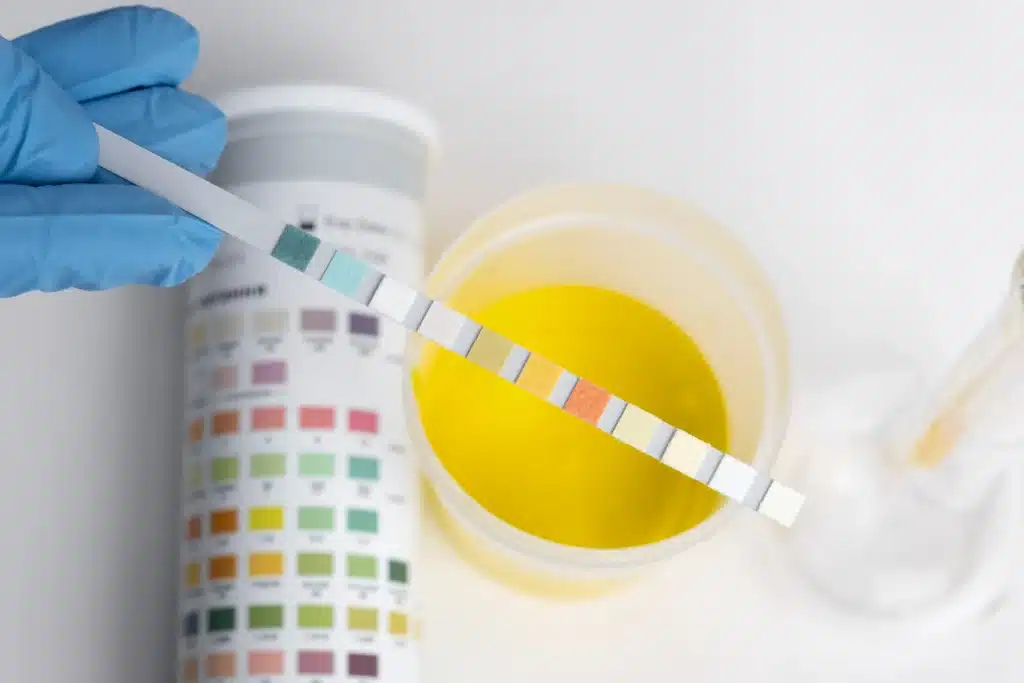 Pentingnya Drug Test di Rural Area