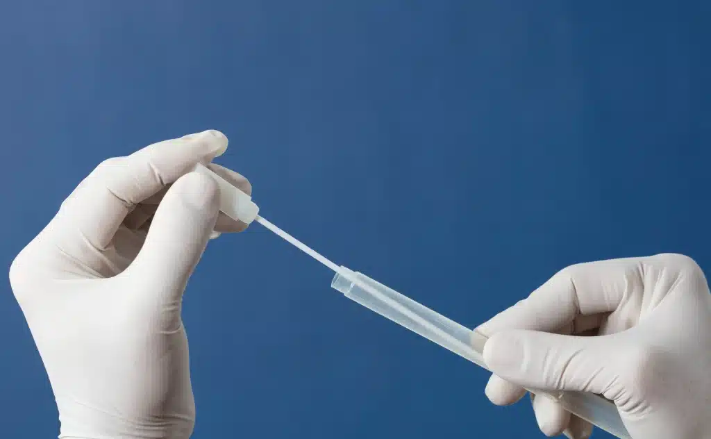 Rectal swab adalah prosedur medis yang digunakan untuk mendeteksi adanya patogen tertentu.