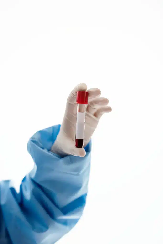 Apa Itu HbA1c dan Fungsinya dalam Medical Check-Up Karyawan?
